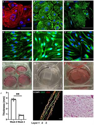 Layer-By-Layer Fabrication of Thicker and Larger Human Cardiac Muscle Patches for Cardiac Repair in Mice